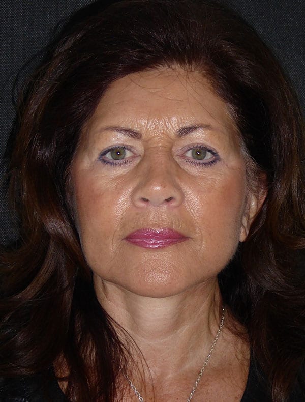 Linda, 66